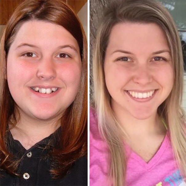 https://dovolenauzubare.cz/wp-content/uploads/2023/01/dental-braces-before-after-184-5926983c1a019__605-1.jpeg